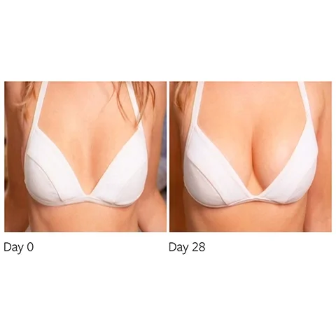 before and after