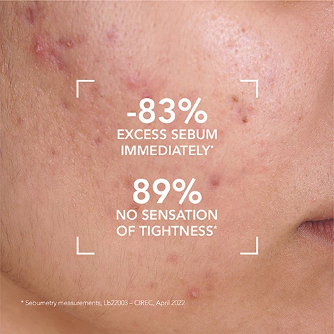 image 1, -83% excess sebum immediately. 89% no sensation of tightness. sebumetry measurements. image 2, 100% purified skin, sebumetry measurements. image 3, copper sulphate - purifying properties. zinc sulphate - purifying and seboregulating properties. image 4, naig d said - this is my new routine. i found a soap that purified my skin without damaging it or drying it out. it is effective. the bottle is practical and allows you to keep the foaming gel for a long time. image 5, oily to acne-prone skin. 1 = cleanse, 2 = care, 3 = treat. image 6, 1 = apply sebium foaming gel daily on wet skin. 2 = work into a foam. 3 = rinse and gently dry.
