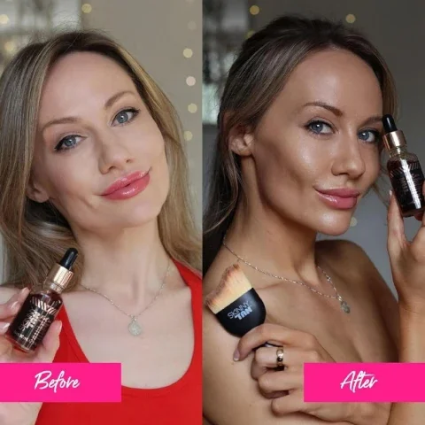 Before and After