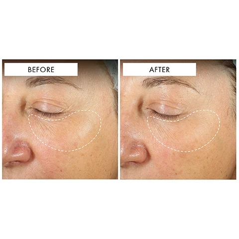 image 1, before and after. image 2, 42% reduction of wrinkles in 2 weeks. 39% improvement in skin firmness. 35% improvement in skin brightness.