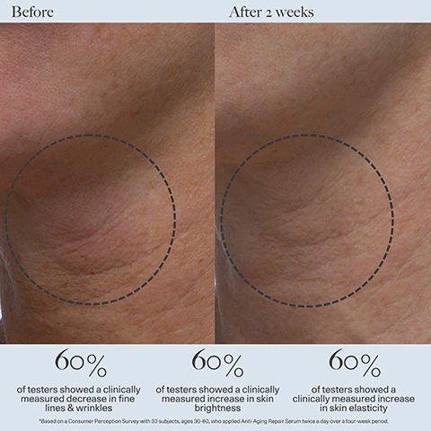 Image 1 - Image shows a side-by-side comparison of skin before and after two weeks of using an anti-aging serum, with circles highlighting the treated areas; visible text reads 60% of testers showed a clinically measured decrease in fine lines & wrinkles, 60% of testers showed a clinically measured increase in skin brightness, and 60% of testers showed a clinically measured increase in skin elasticity.
Image 2 - A split image showing skin before and after two weeks of using a serum, with the left side displaying uneven skin tone and spots, while the right side shows smoother skin; text reads 100% showed clinically measured improvement in skin texture, 100% showed clinically measured improvement in fine lines & wrinkles, 100% showed clinically measured improvement in skin elasticity.
Image 3 - An image featuring three transparent blocks labeled with skincare ingredients, including 3% Tetrahexyldecyl Ascorbate, Lilac Stem Cells, and Marine Algae Extracts, accompanied by small purple flowers. Text on the image includes the descriptions of each ingredients benefits.