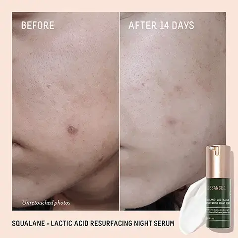 Image 1, BEFORE AFTER 14 DAYS Unretouched photos SQUALANE + LACTIC ACID RESURFACING NIGHT SERUM ISSANCER LANE LACE RACING NIGHT Image 2, SSANCE. LANE LACTIC ACID SURFACING NIGHT SERUM Serum Exfoliates Skin Overnight age exfue la peau pendant l AFTER 1 NIGHT Panelists showed +113% improvement in skin hydration' 100% showed improvement in the appearance of pores1 100% showed a visible reduction in the appearance of fine lines and wrinkles1 Based on a clinical study of 36 female subjects, oges 30-60. cfter one use Image 3, RADIANT COMPLEXION DYNAMIC DUO AM SQUALANE + VITAMIN C DARK SPOT SERUM Correct and prevent dark spots Even skin tone BIOSSANCE: SQUALANE. VITAMINC CARK SPOT SERUM BOSSANCE ALANE LACTIC ACID ESURFACING NIGHTSER MO CPM SQUALANE LACTIC ACID RESURFACING NIGHT SERUM Reduce look of large pores Smooth rough texture Image 4, 10% VEGAN LACTIC ACID Gently smooths overnight for visibly glowing, radiant skin in the morning BIOSSANCES SQUALANE LACTIC AC RESURFACING NIGHT SE ◆ CLOVER Boosts lactic's exfoliating benefits by reviving up cell turnover PR62 SUGARCANE-DERIVED SQUALANE Provides weightless hydration and locks in long-lasting moisture Image 5, FIND YOUR SERUM SUPERHEROBIOSSANCESBIOSSANCE:.SQUALANE+SUGARCANSOUALANFIRM AND LIFT DUAL SERUMsibly Tightens Hyaluronic Acid asserre visiblement les pores. ehylauroniqueBIOSSANCE:SQUALANE + COPPER PEPTIDE RAPID PLUMPING SERUMInstant Hydration with Hyaluronic Acid & ParacressUne hydratation instantanée avecde l'acide hyaluronique et du cresson de paraBIOSSANCESQUALANE VITAMIN C DARK SPOT SERUM10% Vitamin C&White Shiitake Visibly Improve Discoloration10% Vitamine Cet champignon shiitake blanc améliorent visiblement la décoloration-SQUALANE+10% LACTIC AC RESURFACING SERUMNight Serum with Vegan Lactic Acid Gently Exfoliates Strum de nuit à l'acide lactique vegan folie en douceurOML/1.01 FL. OZ.THE TOTAL LIFTTHE POWER PLUMPERTHE POWER VANISHERTHE ULTIMATE SMOOTHERFIRM AND LIFT DUAL SERUMVisibly firms, lifts, and sculpts your skinCOPPER PEPTIDE RAPID PLUMPING SERUMPlumps and replenishesmoistureVITAMIN C DARK SPOT SERUMTargets dark spots and brightensLACTIC ACID RESURFACING NIGHT SERUMExfoliates away dull skin
