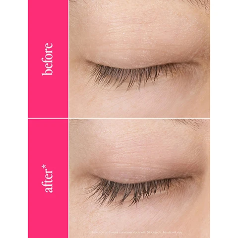 Image 1 - An image showing two close-up photos of an eye, with the top labeled before and the bottom labeled after, highlighting the improvement in eyelash length and thickness.
Image 2 - A side-by-side comparison showing a close-up of a persons closed eyes with visible eyelashes; the top image labeled before shows shorter eyelashes, while the bottom image labeled after shows longer, fuller eyelashes, with a note that results may vary.
Image 3 - A woman with long, wavy hair is holding a lash serum in one hand and looking at the camera; the background is pink with text that reads 2 weeks healthier, stronger looking lashes* and 4-6 weeks longer, thicker looking lashes*.
Image 4 - A hand holding a gold eyelash serum tube is shown against a bright pink background, accompanied by text from Allure and NewBeauty highlighting positive reviews: If youve tried everything but a lash serum to get longer-looking eyelashes, its time you invest in this top pick. and The results look and feel natural - like your lashes, but better. with icons indicating awards and reviews.
Image 5 - Image of an award-winning lash enhancing serum with a black and gold tube positioned upright beside its applicator brush, with pink text that reads promotes longer & thicker looking lashes in as little as 4-6 weeks compatible with lash extensions, lash-lifts, falsies, & contacts easy to use apply 1x daily 11 safety studies & ophthalmologist tested.
Image 6 - An image featuring a tube of lash serum surrounded by honeycomb, aloe vera, and radishes, with text that reads PACKED WITH CREDIBLE, SCIENCE BACKED, Lash Loving Ingredients and lists ingredients including Hyaluronic Acid and Honey & Aloe Vera.
Image 7 - A close-up of a persons eye being treated with a brush, with text instructions that read apply 1x daily for 3 months for full results, apply single stroke to upper lash line, and let dry for 2-3 minutes before applying other products or laying down.
Image 8 - Image shows a guide for lash serum sizes with three product options labeled as Travel Size (6 Week Supply), Full Size (3 Month Supply), and Jumbo Size (6 Month Supply), each with text indicating results at different stages: Week 6 - Perfect to try Im starting to see initial results, Week 12 - Full Results My lashes look UNREAL, and 6 Months - Maintain Results I cant live without it.