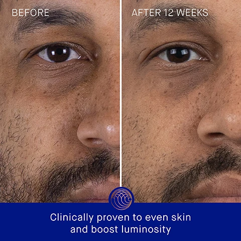 Image 3 - A side-by-side comparison of a mans face before and after using a skincare product, showing noticeable improvement in skin tone; visible text reads BEFORE, AFTER 12 WEEKS, and Clinically proven to even skin and boost luminosity.
Image 4 - Side-by-side comparison of a mans face showing visible skin improvements, labeled BEFORE on the left and AFTER 12 WEEKS on the right, with text at the bottom stating Clinically proven to reduce the appearance of blemishes.
Image 5 - A serum bottle is displayed on a gradient background with the text: Clinically Proven Results, The appearance of even skin tone is improved by over 3.6x, The appearance of wrinkles is reduced by 85%, Skin hydration is improved by over 3.9x, *In a 12-week Clinical Trial of 30 women and men between the ages of 18 - 65.
Image 6 - An elegant gold serum bottle is positioned against a textured stone background, with text highlighting user feedback: 95% agree skin looks more luminous, 98% agree skin feels soft, supple and more elastic, 93% agree fine lines and wrinkles appear reduced, and a note about a consumer perception study at the bottom.
Image 7 - An orange serum bottle labeled THE SERUM WITH TFC8 is centered on a blue gradient background, surrounded by descriptions of its ingredients: TFC8, Edelweiss Extract, Pomegranate Seed Concentrate, and Vitamin C, each accompanied by related benefits.
Image 8 - Image shows a step-by-step skincare application process with three images: the top image features several orange cylindrical bottles, the middle image shows a person smoothing a product onto their skin using a golden applicator, and the bottom image displays a close-up of a person applying a cream to their face; text includes steps 1 to 3: Step 1 Dispense 2 pumps into hands, Step 2 In upward sweeping motions, smooth over the face, neck and décolleté until fully absorbed, Step 3 Follow by applying your Augustinus Bader moisturizer and eye cream.
Image 9 - Two skincare products are displayed side by side: the left features an orange bottle labeled The Serum with details about its lightweight gel-serum texture, key benefits of correcting and illuminating, concerns of fine lines, dark spots, and ideal for normal to very dry skin; the right shows a blue bottle labeled The Retinol Serum with a lightweight cream-serum texture, key benefits of smoothing and refining, concerns of deep lines and uneven texture, and ideal for oily to very dry skin.
Image 10 - An image displaying a skincare routine with four numbered steps and corresponding product descriptions, including bottles and containers labeled as Cleanse, Correct & Hydrate, Nourish & Renew, and Perfect & Revitalize.
Image 11 - Three skincare products are displayed: two gold-colored serum bottles labeled 15 ml Refill and 30 ml Refill, and a tall blue bottle labeled 30 ml, with the brand name Augustinus Bader visible on the front of each.