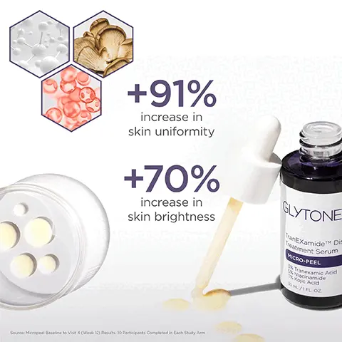 Image 1: +91% increase in skin uniformity and +70% increase in skin brightness. Image 2: Tranexamide discoloration treatment serum before and after 12 weeks model shot. Clinically shown to reduce appearance of dark spots and brighten uneven skin tone caused by sun damage