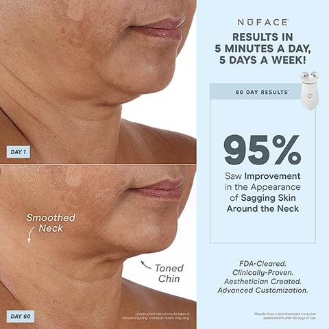Image 1, results in 5 minutes a day, 5 days a week. day 1 and day 60 - smoothed neck and toned chin. unretouched clinical results taken in standard lighting, individual results may vary. 60 day results - 95% saw improvement in the appearance of sagging skin around the neck. FDA cleared, clinically proven, aesthetician created, advanced customisation. results from a post treatment consumer questionnaire after 60 days of use. image 2, 1 device, 3 attachments, endless treatments. built in sensor = ensures consistent microcurrent intensity for all skin types. effective lip and eye attachment - lifts and tightens hard to reach areas around mouth and eyes. energizing hum. boost button for +25% microcurrent power. 3 intensity levels. smart device technology - perfect for advanced customisation. unlock exclusive treatments. FDA cleared, clinically proven, aesthetician created. unlock exclusive treatments. bluetooth enabled, pair with the nuface smart app. image 3, targeted results. lift the brow, lift lips and smile lines. tighten skin around the eyes. image 4, results in 5 minutes a day, 5 days a week. day 1 and day 60 - lifted brow. unretouched clinical results taken in standard lighting, individual results may vary. 60 day results - 80% saw a lifted brow and awakened eye. FDA cleared, clinically proven, aesthetician created, advanced customisation. results from a post treatment consumer questionnaire after 60 days of use. image 4, targeted results. lift the brow, lift lips and smile lines. tighten skin around the eyes. image 4, results in 5 minutes a day, 5 days a week. day 1 and day 60 - reduced smile line. unretouched clinical results taken in standard lighting, individual results may vary. 60 day results - 78% saw an improvement in smile lines. FDA cleared, clinically proven, aesthetician created, advanced customisation. results from a post treatment consumer questionnaire after 60 days of use. image 5, 1 device, endless customisable results. instant results that build with consistent use. contour cheeks. lift eyes and brows. tone jowls and jawline. smooth neck and forehead. lift lips and smile lines. image 6, results in 5 minutes a day, 5 days a week. day 1 and day 60 - reduced deep lines. unretouched clinical results taken in standard lighting, individual results may vary. 60 day results - 93% saw reduction in the appearance of deep lines. FDA cleared, clinically proven, aesthetician created, advanced customisation. results from a post treatment consumer questionnaire after 60 days of use. image 7, microcurrent 101 = a low level electrical current that mimics and re-energizes the body's natural current to tone, lift and contour down to the muscles. skincare is your nutrition, micro current is your fitness. trinity+ is fitness for your face. image 8, unlock app exclusive treatments to target different layers of skin and muscles. help reduce wrinkles and plump skin skin tightening mode. helps instantly lift and contour instant lift mode. long term muscle sculpting pro toning mode. after 15 minutes of use. after 14 days of use. unlocked with nuFACE app. image 9, smart app. follow step by step tutorials. track progress. customise results with app exclusive treatments. set treatment reminders. image 10, comparison of three nuface devices. trinity+ advanced customisation. unlock app exclusive treatments - yes. boost with 25% microcurrent - yes. nuface smart app - yes. attachment options (eye and lip attachment and LEF red light attachment sold separately - yes. microcurrent treatment areas - jowls and jawline, neck, cheeks and forehead, around eyes and brows, around mouth and lips, smile lines. mini+ on the go lifting. unlock app exclusive treatments - yes. boost with 25% microcurrent - no. nuface smart app - yes. attachment options (eye and lip attachment and LED red light attachment sold separately - no. microcurrent treatment areas - jowls and jawline, neck, cheeks and forehead. fix, instant finisher.