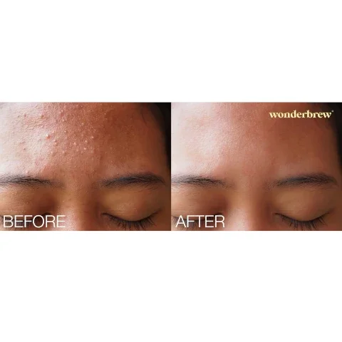 before and after
