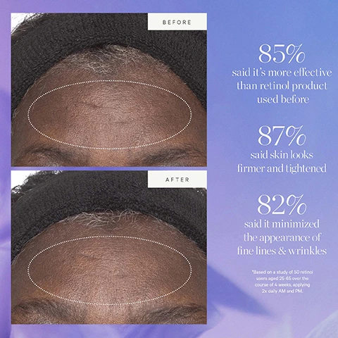 Image 1 - Before and after images show a persons forehead with oval highlights comparing skin appearance alongside text stating BEFORE AFTER 85% said its more effective than retinol product used before 87% said skin looks firmer and tightened 82% said it minimized the appearance of fine lines & wrinkles Based on a study of 50 retinol users aged 25-65 over the course of 4 weeks applying 2x daily AM and PM. Image 2 - Close up of dark berries with water droplets and text ACAI PLANT STEM CELL TIGHTEN FIRM SMOOTH. Image 3 - Illustration shows a diagram of a jar with a removable refill pod and instructions on how to recycle it including KEEP YOUR GLOW WITHOUT THE WASTE HOW TO RECYCLE Plant Stem Cell Retinol Alternative Moisturizer Remove empty pod Rinse out any remaining or excess product Recycle the pod* Place new refill pod into glass jar *CONFIRM YOUR LOCAL RECYCLING PROGRAM. Image 4 - Image shows old purple packaging and new white packaging for Kora Organics Plant Stem Cell Retinol Alternative Moisturizer refill pod with text New Look, Same Formula, KORA ORGANICS, PLANT STEM CELL RETINOL ALTERNATIVE MOISTURIZER - REFILL POD, HYDRATE, TIGHTEN & PLUMP, 50 mL 1.69 fl oz, NEW, and Please note: Packaging may vary. For a limited time, you may receive either of these packages.
