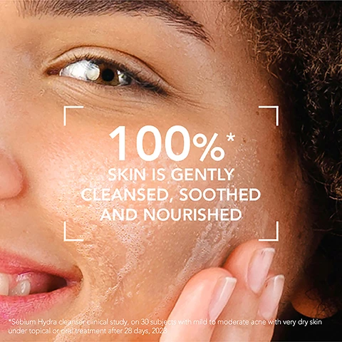 image 1, 100% skin is gently cleansed, soothed and nourished. image 2, 87% skin is lastingly hydrated. image 3, gentle surfactants cleansing. DAF soothing. NMF like active ingredient - moisturising. image 4, acne prone skin, ultra dry due to treatments. 1 = cleanse. 2 = moisturise. image 5, 1 = cleanse your face with sebium hydra cleanser. 2 = apply sebium hydra to moisturise your face. image 6, this cleansing balm with a smooth texture enables me to cleanse my weakened skin without friction. after rinsing my skin is more comfortable, less tight. image 7, elodie valin - scientific valorisation director said - inspired by ecobiology, NAOS research has developed serbium hydra cleanser, a moisturising cleansing balm specially designed for a skin that has been weakened by acne treatments, combining performance, high tolerance and care right from the cleansing step.