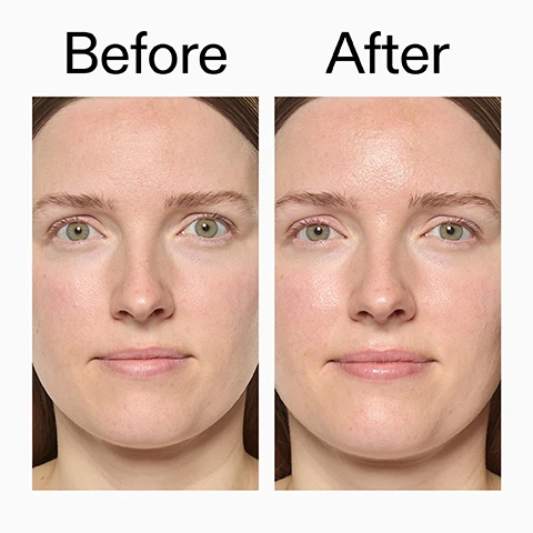 Image 1 - A split image showing a womans face with a natural, less radiant complexion on the left and a smoother, more glowing, hydrated complexion on the right, with the text Before After. Image 2 - A close-up shows a person with brown skin applying a white cream to their cheek with a finger, alongside text that reads Clinically proven to visibly improve skin radiance in 4 weeks*, Clinically proven to boost skin hydration by 166% after one use**, Leaves skin looking smooth, plump and refreshed, *4-week independent clinical study of 22 people under dermatological control., **Clinical study of 31 people. Image 3 - A close-up of two womens faces, one with dark skin and one with light skin, both showing radiant, hydrated complexions, accompanied by the text Why we love Exosome Hydro-Glow Complex, Brightens and hydrates, Post-facial glow, without the cost, Hydrates and supports the skin barrier. Image 4 - A close-up of a person applying light pink cream to their cheek, with text that reads: Why we love Omega Water Cream. Lightweight, oil-free hydration. Non-greasy, glowy finish. Great for oily and blemish-prone skin. Image 5 - A glossy, light yellow swirl of skincare product on a white background with text explaining: How to layer Repair & Hydrate Duo. 1 Exosome Hydro-Glow Complex. APPLY 1-2 PUMPS TO CLEAN, DRY SKIN AFTER CLEANSING. 2 Omega Water Cream. APPLY A THIN LAYER OVER FACE AND NECK TO LOCK IN HYDRATION AND GLOW. Image 6 - Two white and black The Inkey List skincare products, an Omega Water Cream tube and an Exosome Hydro-Glow Complex bottle, are displayed on a black surface, with an IN Award sticker from The Industry Beauty Innovators Winner 2023 New Product Skincare (Mass) visible above the bottle. The Omega Water Cream tube shows text reading THE INKEY LIST OMEGA WATER CREAM 1.7 US fl.oz / 50ml e Lightweight and hydrating Léger et hydratant, and the Exosome Hydro-Glow Complex bottle shows text reading 1.0 US fl.oz / 30ml e EXOSOME HYDRO-GLOW COMPLEX THE INKEY LIST.